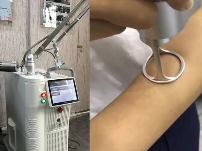 3D 4D Fractional Co2 Laser